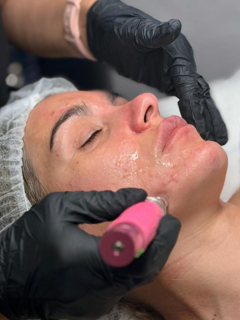 Higiene facial personalizada Vero Nails El Casar de Escalona mayo 2026